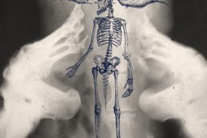 drawing, X rays, Ambient, Bones