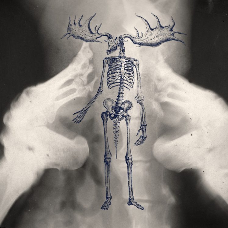 drawing, X rays, Ambient, Bones HD Wallpaper Desktop Background