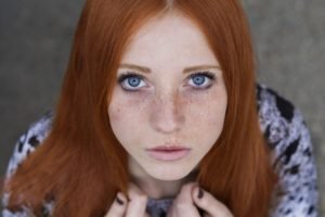 redhead, Freckles
